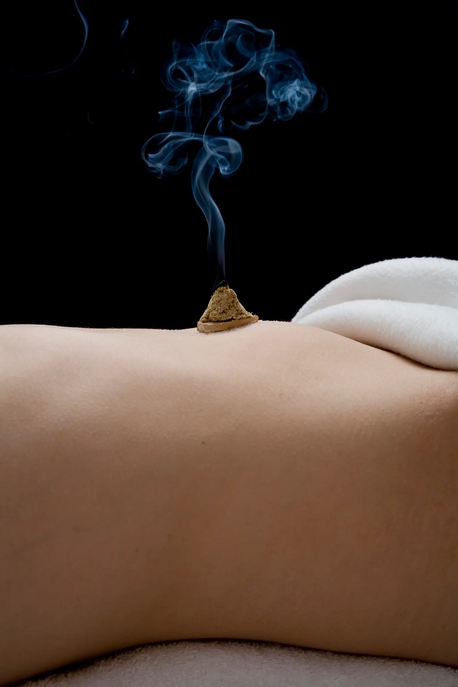 Moxibustion