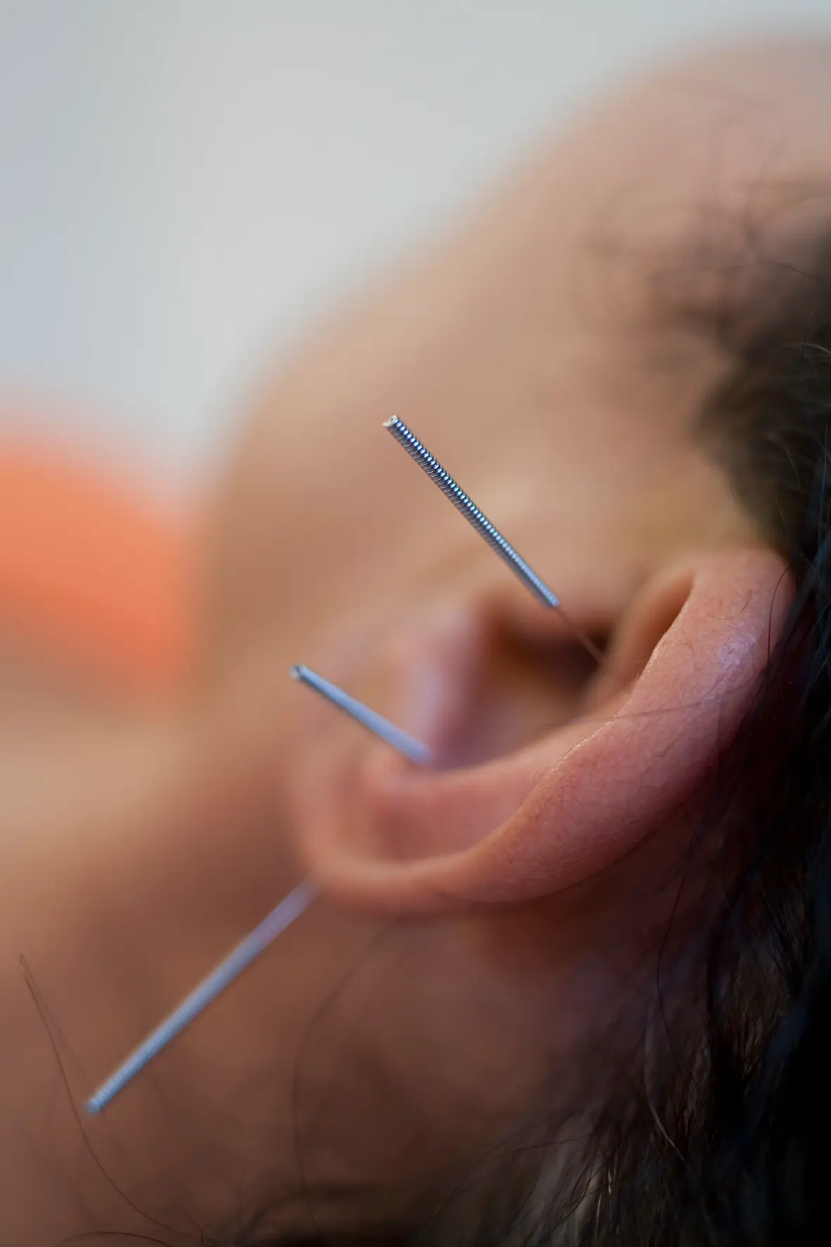 TCM Behandlung für Hormonstörungen
